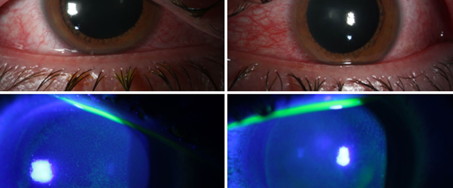 How to Maximize the Effectiveness of UV Lights